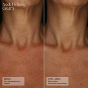 Senté Neck Firming Cream - Art of Skin Care