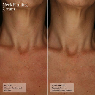 Senté Neck Firming Cream - Art of Skin Care