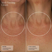 Senté Neck Firming Cream - Art of Skin Care