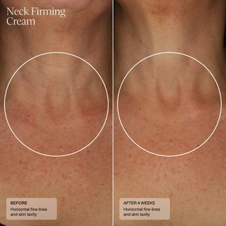 Senté Neck Firming Cream - Art of Skin Care