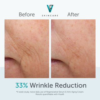 Before and after showing 33% wrinkle reduction after 4 weeks using FactorFive Anti-Aging Cream