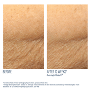 Skinbetter AlphaRet Body Overnight Cream - Art of Skin Care
