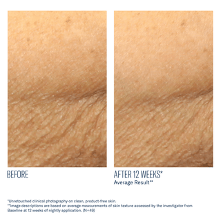 Skinbetter AlphaRet Body Overnight Cream - Art of Skin Care