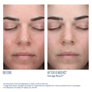 Skinbetter AlphaRet Clearing Serum - Art of Skin Care