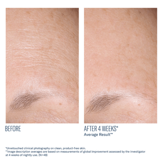 Art of Skin Care | skinbetter AlphaRet Overnight Cream before and after smoother forehead fewer fine lines 4 weeks N=48
