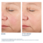 Skinbetter Alto Advanced Defense and Repair Serum - Art of Skin Care
