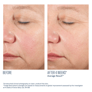 Skinbetter Alto Advanced Defense and Repair Serum - Art of Skin Care
