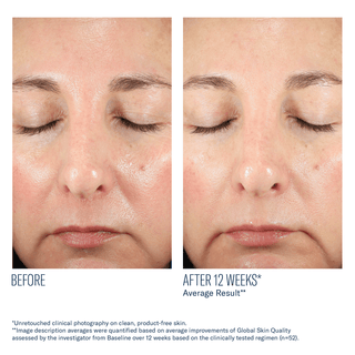 Skinbetter BioRewind Skin Health Supplement - Art of Skin Care