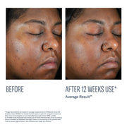 Skinbetter Even Intensive Skin Tone Correcting Serum - Art of Skin Care