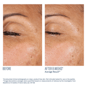 Skinbetter EyeMax AlphaRet Overnight Cream - Art of Skin Care