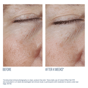 Art of Skin Care | skinbetter Instant Effect Gel EYE improved fine lines texture younger-looking skin 4 weeks N=15