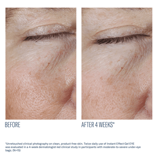 Art of Skin Care | skinbetter Instant Effect Gel EYE improved fine lines texture younger-looking skin 4 weeks N=15