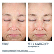 Art of Skin Care | skinbetter science before and after reduced fine lines wrinkles redness forehead eyes chin 16 weeks
