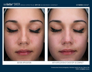 SsunBetter SHEER Broad Spectrum SPF 56 Sunscreen Compact before and after clinical photo showing redness and uneven skin tone before application on left, and a smoother more balanced complexion with natural non-whitening finish on right. Unretouched clinical photography. Available at Art of Skin Care