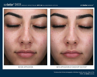 sunBetter SHEER Broad Spectrum SPF 56 Sunscreen Stick before and after clinical photo showing visible pores and mild redness before application on left, and a more refined, natural-looking complexion with sheer non-whitening finish on right. Unretouched clinical photography. Available at Art of Skin Care