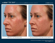 sunBetter TONE SMART Broad Spectrum SPF 68 Sunscreen Compact before and after clinical photo showing post-microneedling redness and irritation on left, and visibly calmed, even skin tone with product applied on right. Unretouched clinical photography. Available at Art of Skin CareCare