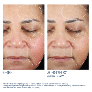 Art of Skin Care | skinbetter Trio Rebalancing Moisture before and after reduced redness improved hydration 4 weeks N=27