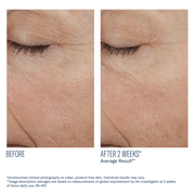 Art of Skin Care | skinbetter Trio Rebalancing Moisture before and after smoother brighter skin 2 weeks N=40