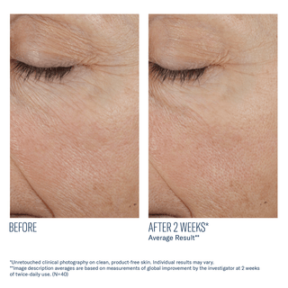 Art of Skin Care | skinbetter Trio Rebalancing Moisture before and after smoother brighter skin 2 weeks N=40